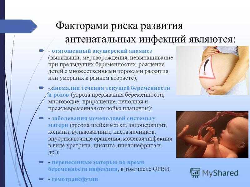 Антенатальная гибель плода