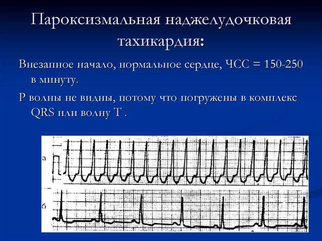 Аффективно-респираторные приступы у детей: причины, симптомы и лечение