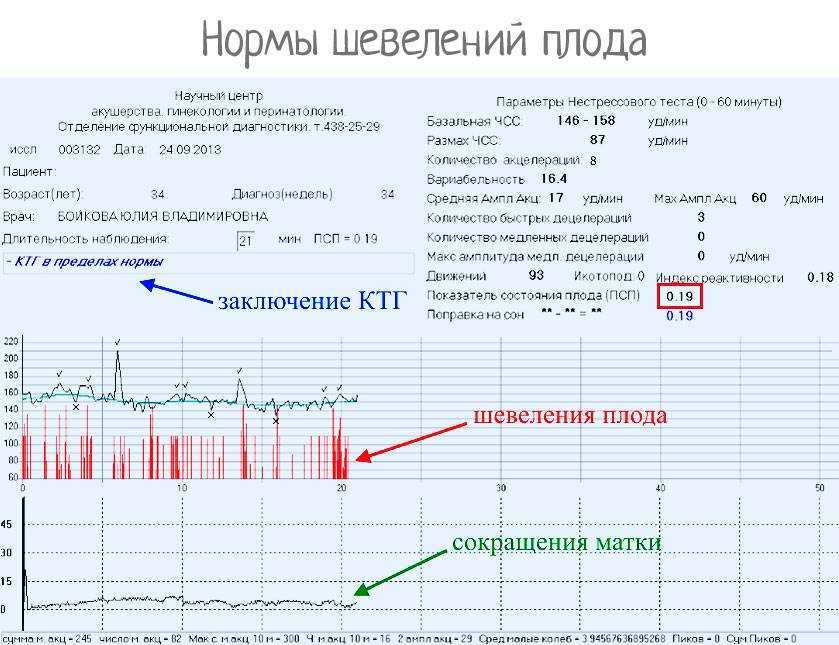 Как отмечать шевеления плода в обменной карте правильно картинки