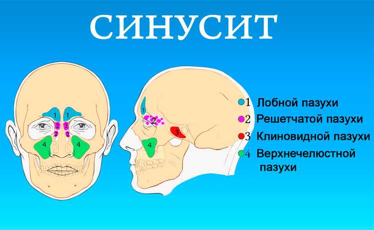 Носовое кровотечение – причины и лечение. носовые кровотечения у взрослых и детей.