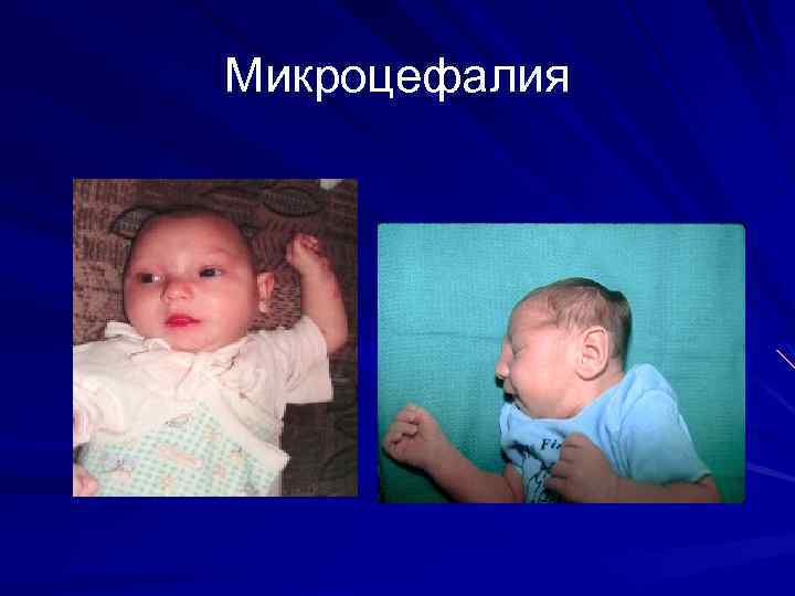 Поражение мозга