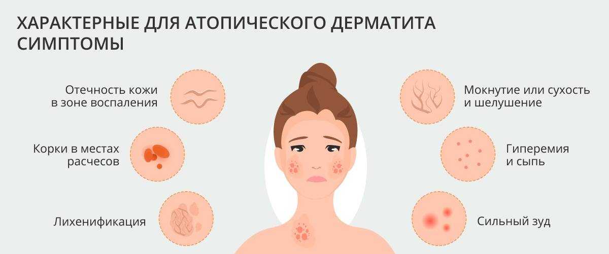 Если у ребенка прыщики на попе, нужно найти причину их возникновения Сыпь может внешне отличаться при различных заболеваниях, поэтому нужно показать ребенка педиатру