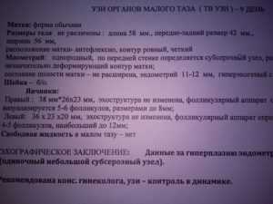 Киста яичника