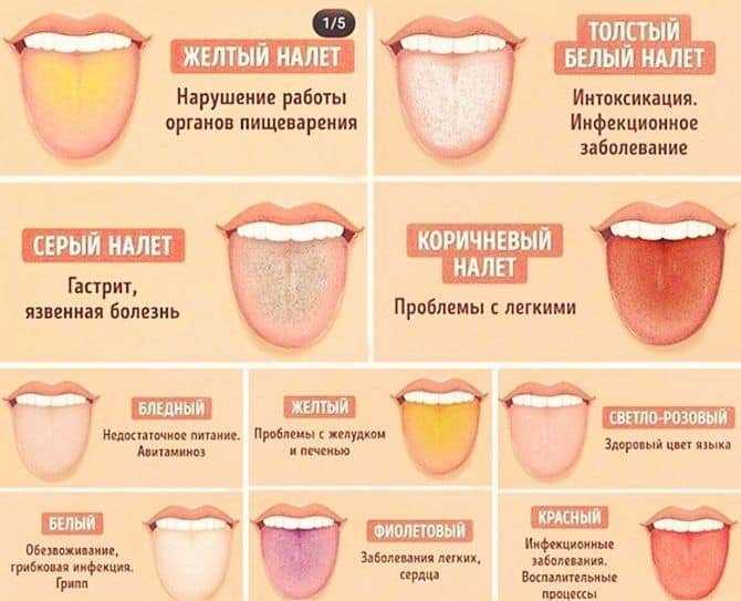 Глоссит - лечение, симптомы, причины - smile4you.ru
