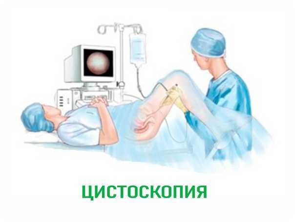 Цистография - что это такое, как проводится, подготовка