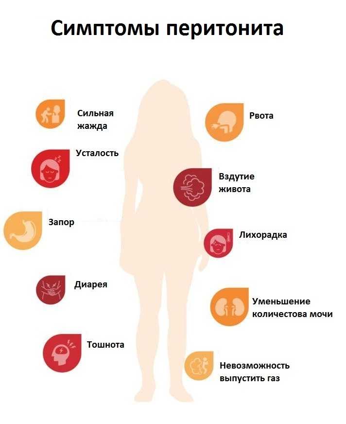 Аппендикулярный перитонит у детей аппендикулярный перитонит у детей выполнил: каримов а.м группа: 746 воп проверил: хамитов м.к нур-султан 2020. - презентация