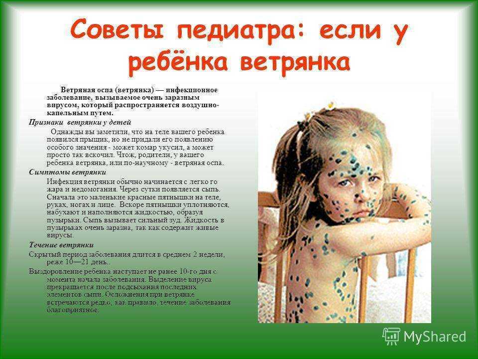 Ветряная оспа — симптомы, вакцинация взрослых — вакцина против опоясывающего лишая
