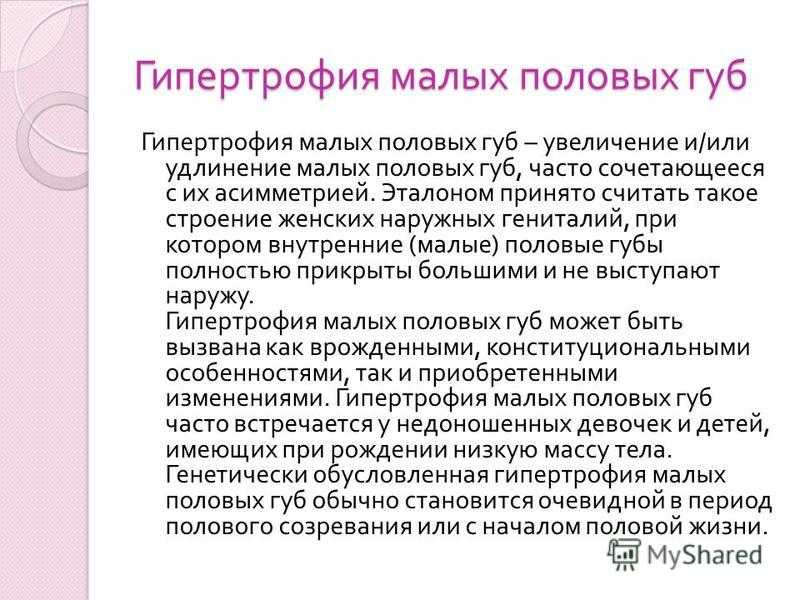 Гипертрофия половых губ – изменение их размера, длины или формы Существует несколько степеней данного отклонения