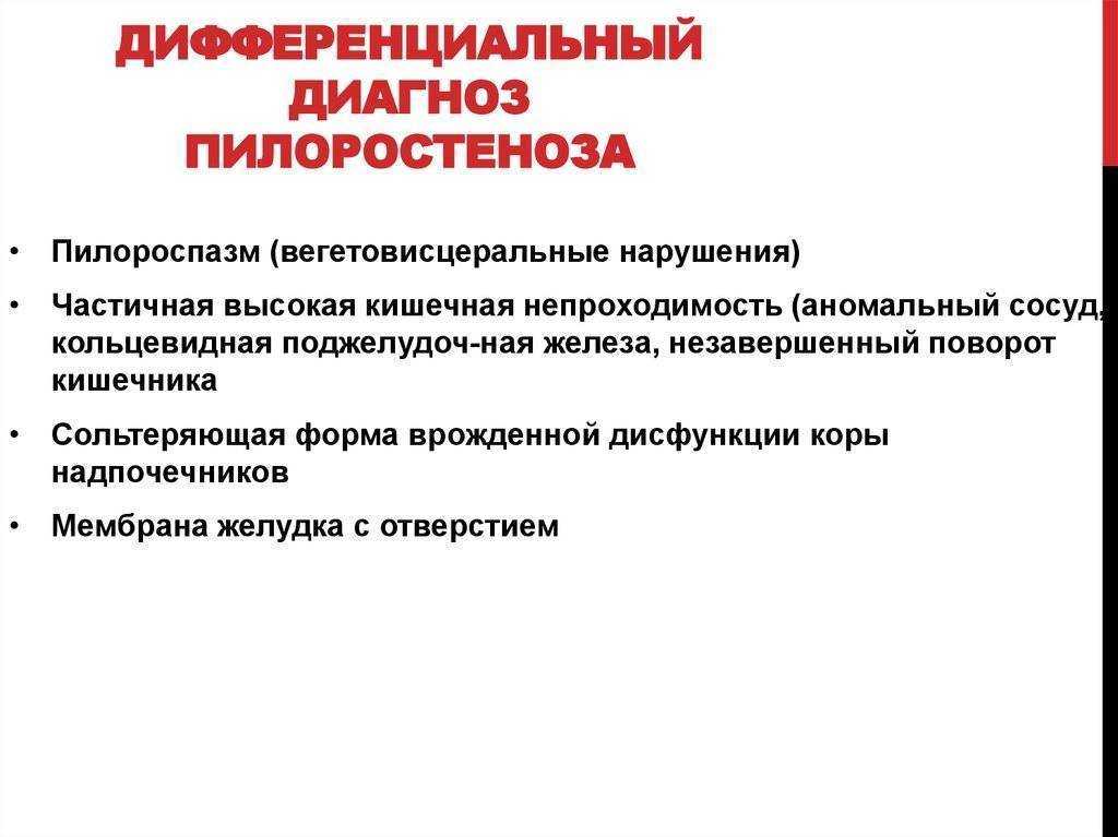 Пилоростеноз у детей