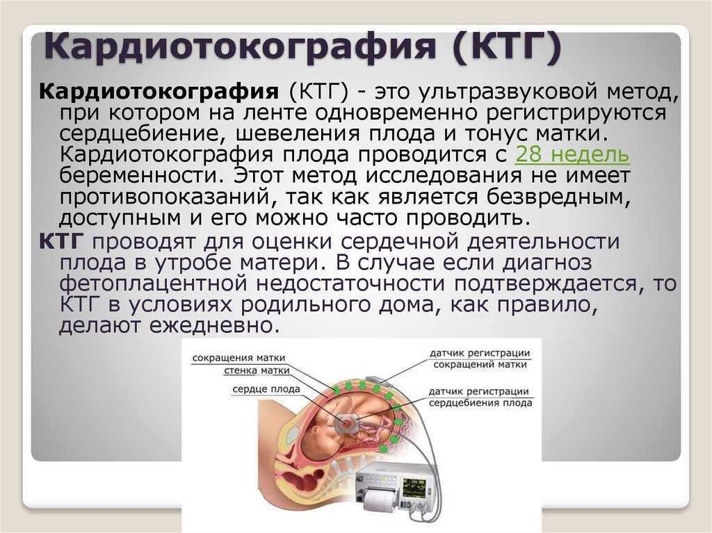 Ктг что это. Кардиотокографии плода. Наружная кардиотокография. КТГ плода методика. Кардиотокография как проводится.