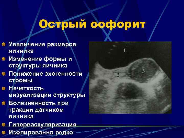 На то, что болят яичники при беременности, жалуется около 10-15% женщин Болезненность может возникать в результате нормальных физиологических процессов или свидетельствовать о заболевании