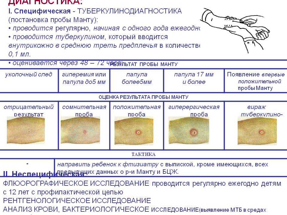 Какая должна быть манту в норме у ребенка в 2 года картинки