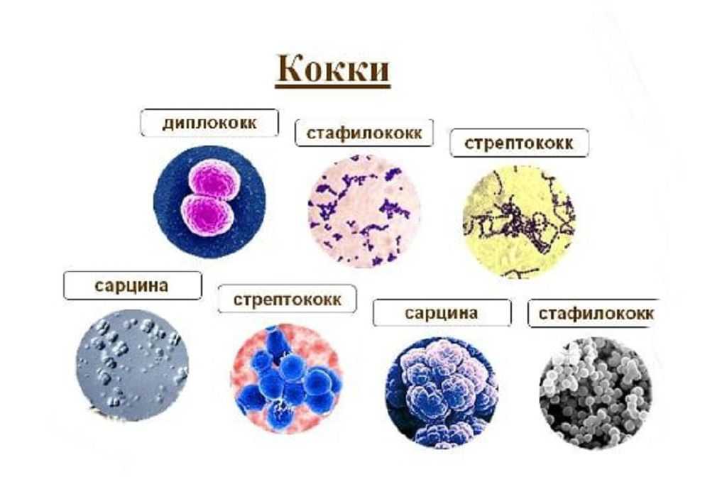 Что это такое диплококки в мазке у женщин, причины появления