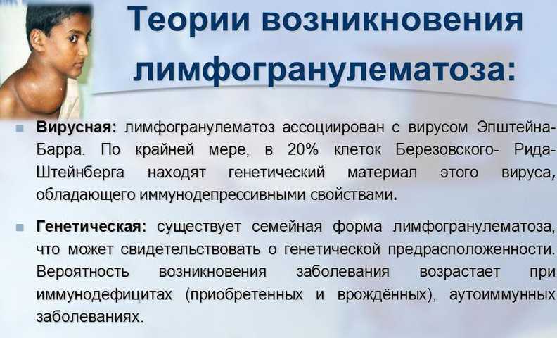 Лимфома ходжкина: сколько живут, причины возникновения, нодулярный склероз, классическая