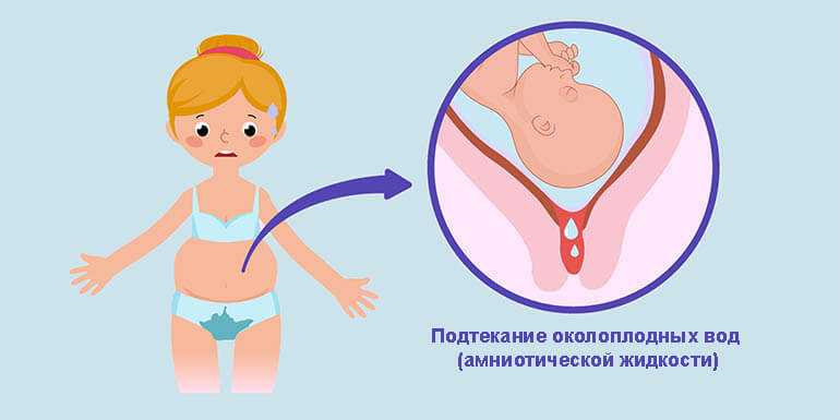 Гиперменструальный синдром: обильные месячные | университетская клиника