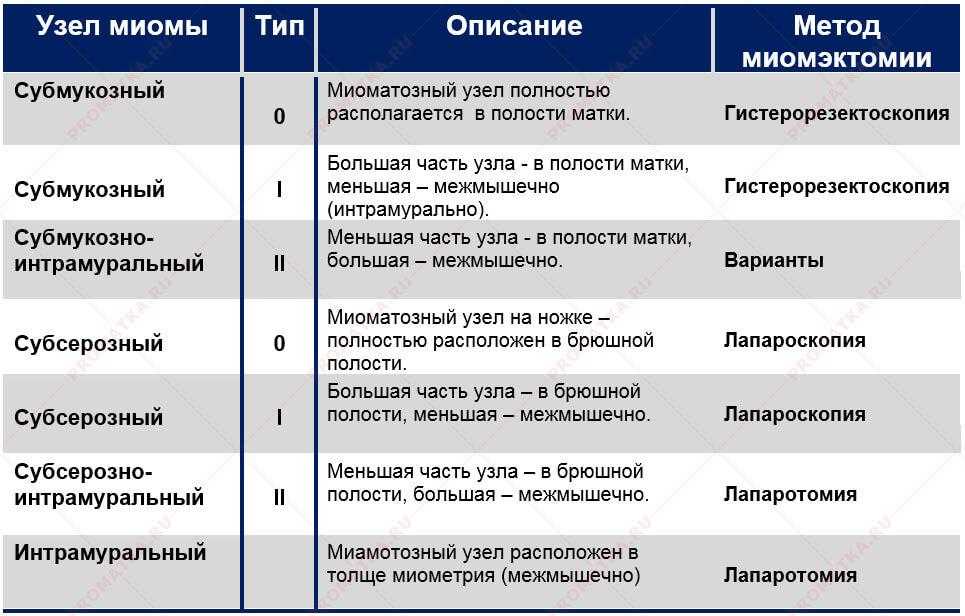 Субмукозная лейомиома матки