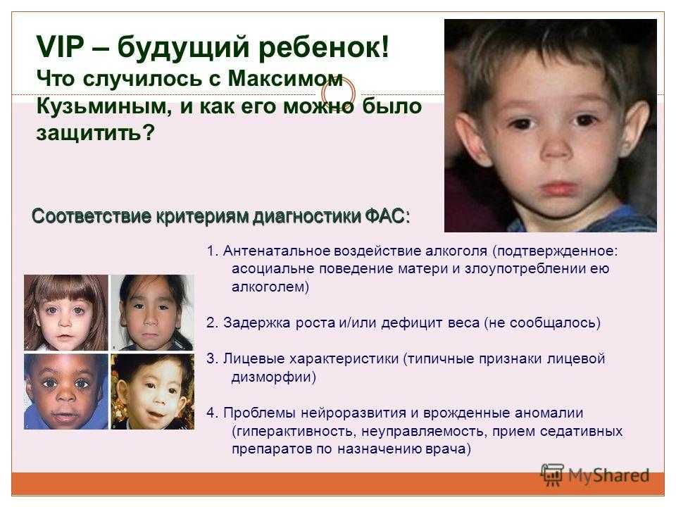 Фетальный алкогольный синдром: что такое болезнь фас и как она лечится?
