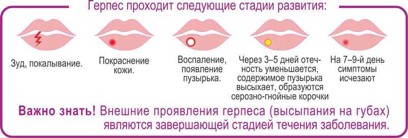 Киста яичника: причины, виды, симптомы, методы диагностики и лечения кисты