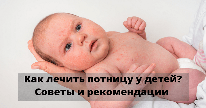 Потничка У Ребенка До Года Фото