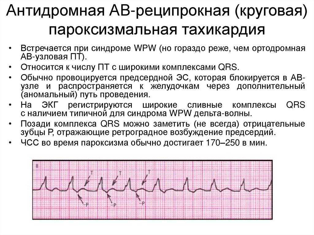 Закатывания или аффективно-респираторные приступы.