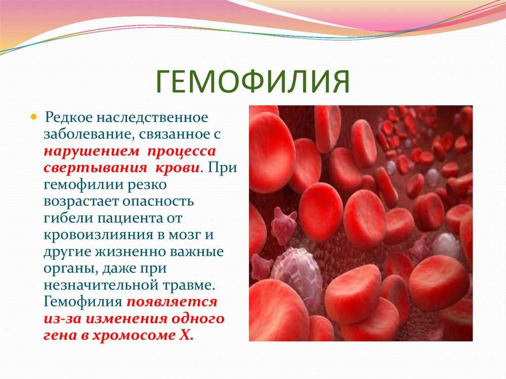 Картинки на тему наследственные заболевания