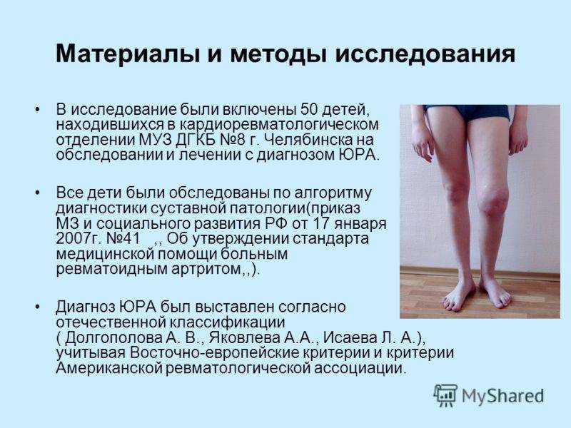 Почему болят колени у ребенка | сеть клиник «здравствуй!»