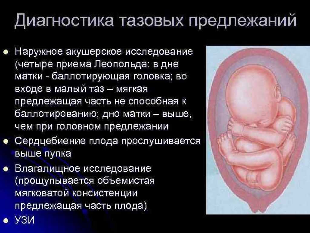 Глава 12. беременность и роды при тазовых предлежаниях плода