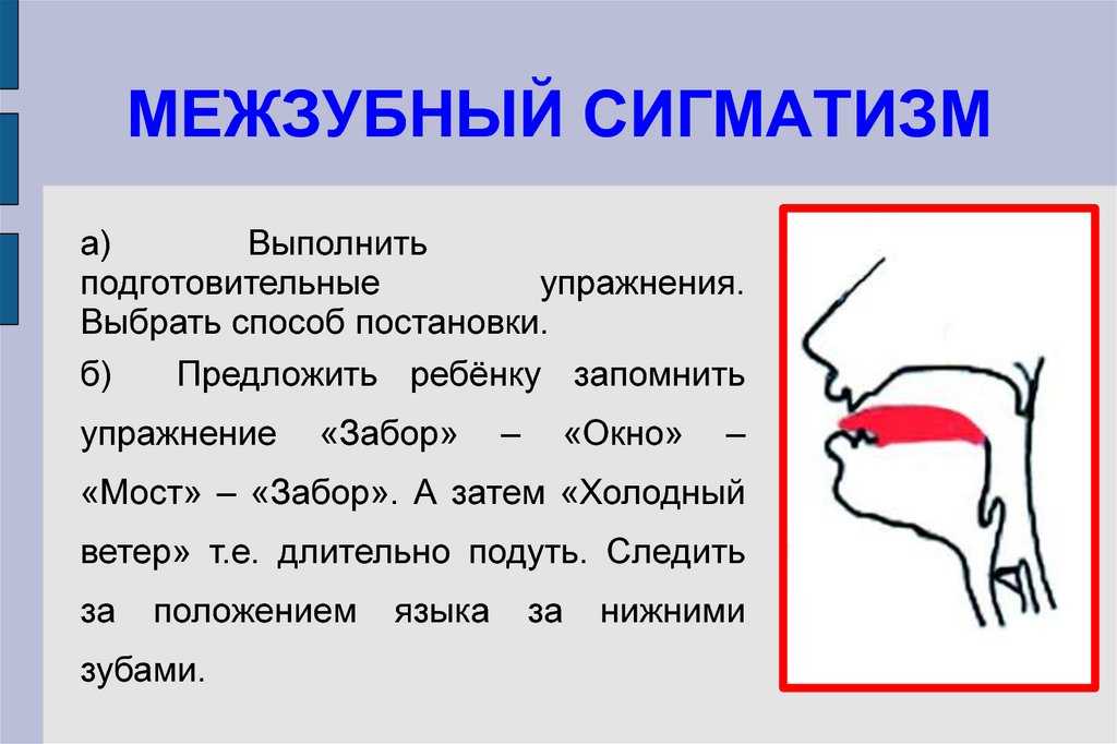 Постановка и автоматизация звука ш: речевой материал, комплекс артикуляционной гимнастики