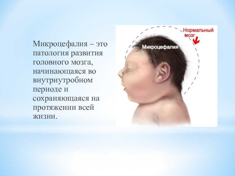 Нейроинфекции у детей