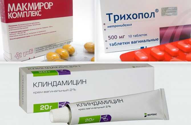 Что такое бактериальный вагиноз или гарднерелла у женщин: причины появления дисбактериоза влагалища