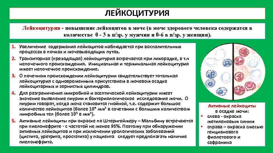 Все, что необходимо знать об общем анализе мочи - клиника в уручье