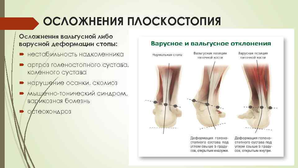 Как научить ребенка сидеть