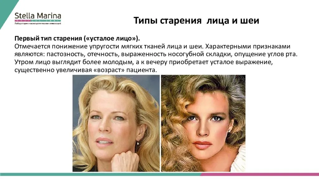 Типы старения кожи и процедуры способные их скорректировать