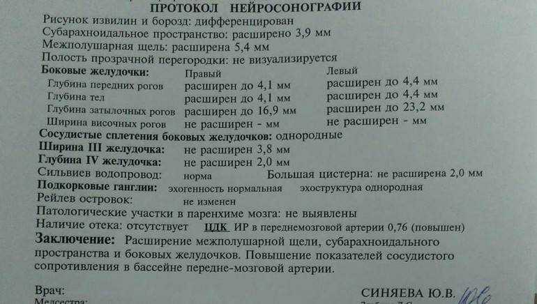 Узи сосудов головного мозга ребенку (нейросонография, нсг) - сколько стоит сделать узи головного мозга ребенку - нейросонография головного мозга новорожденных