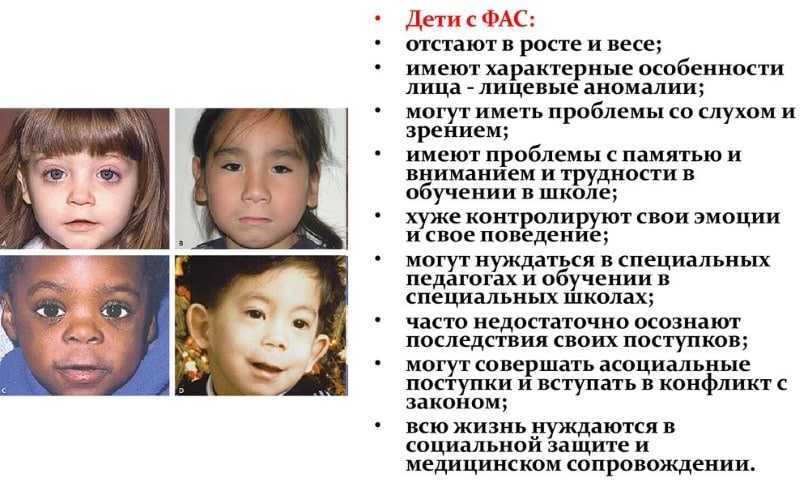 Внешние признаки детей, у которых родители алкоголики - polesno