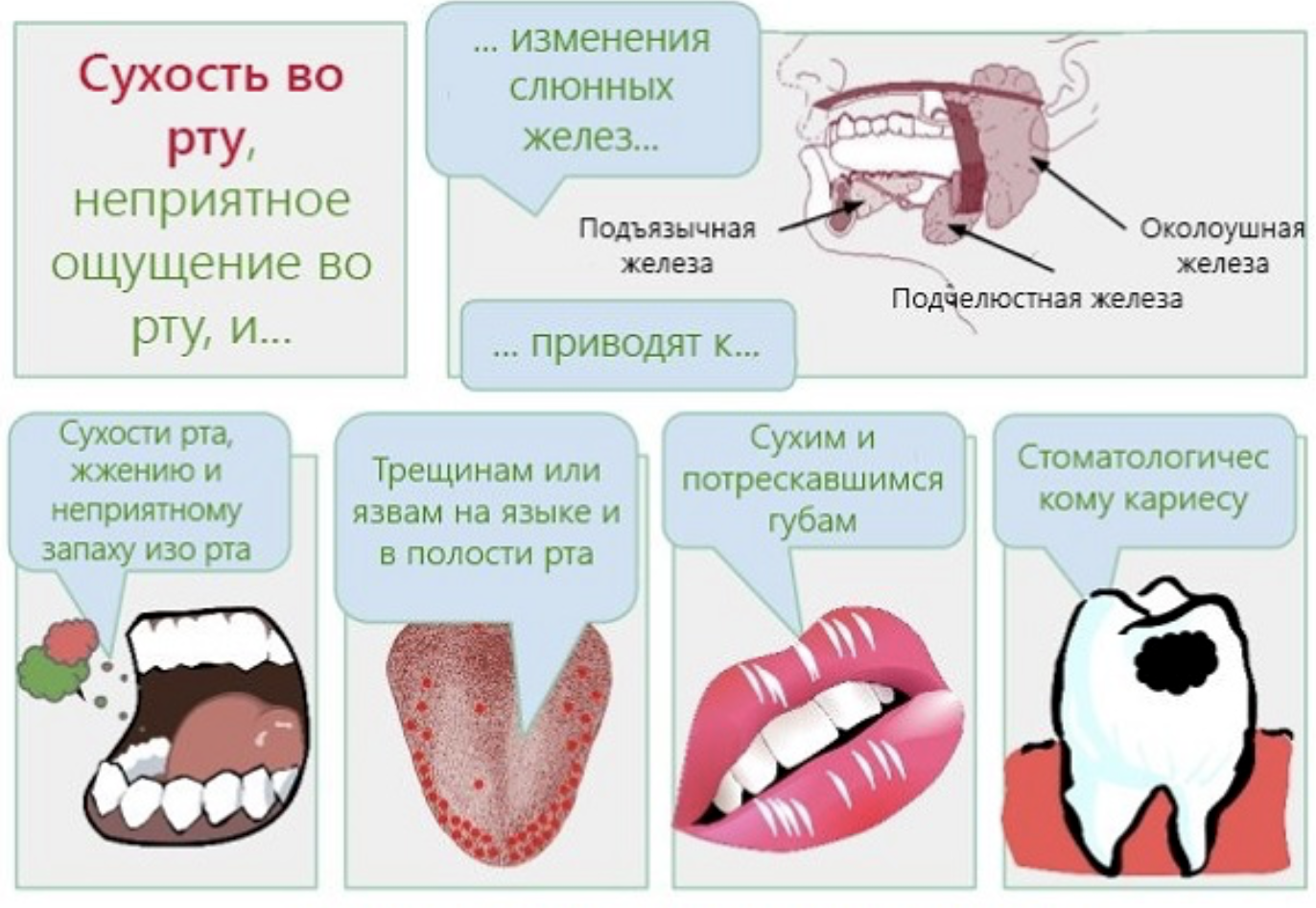 Скарлатина у детей – этапы болезни и классификация