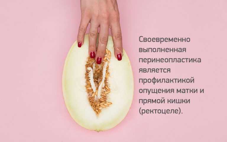 Эпизиотомия как одна из проблем современной перинеологии | борщева | медицинский вестник юга россии