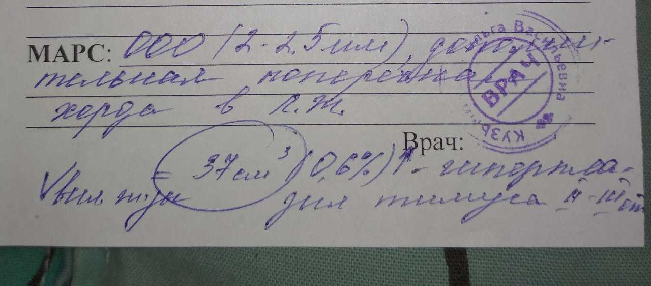 Миокардиодистрофия: что это такое, симптомы и лечение, стадии и формы