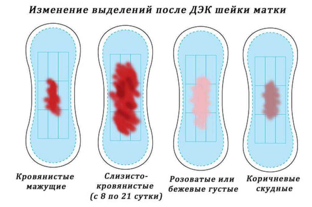 Месячные при беременности
