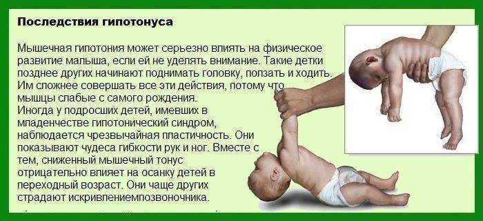 Слово гипертонус, произнесенное педиатром, вызывает у новоиспеченных родителей страх за здоровье своего малыша Большинство молодых мам считает, что гипертонус – это опасный неврологический диагноз Разберемся, так ли это в действительности