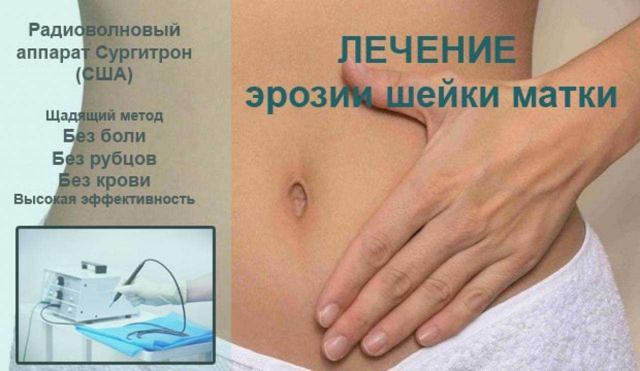 Выделения после прижигания эрозии шейки матки - 10 причин, лечение, профилактика