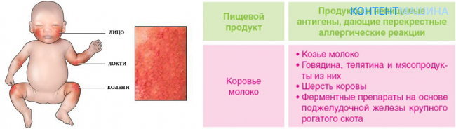 У ребенка 10 месяцев красное. Пищевая аллергия у ребенка грудничка. Сыпь при лактазной недостаточности у новорожденного. Как выглядит пищевая аллергия у ребенка в 1 год. Атопический дерматит у грудничка.