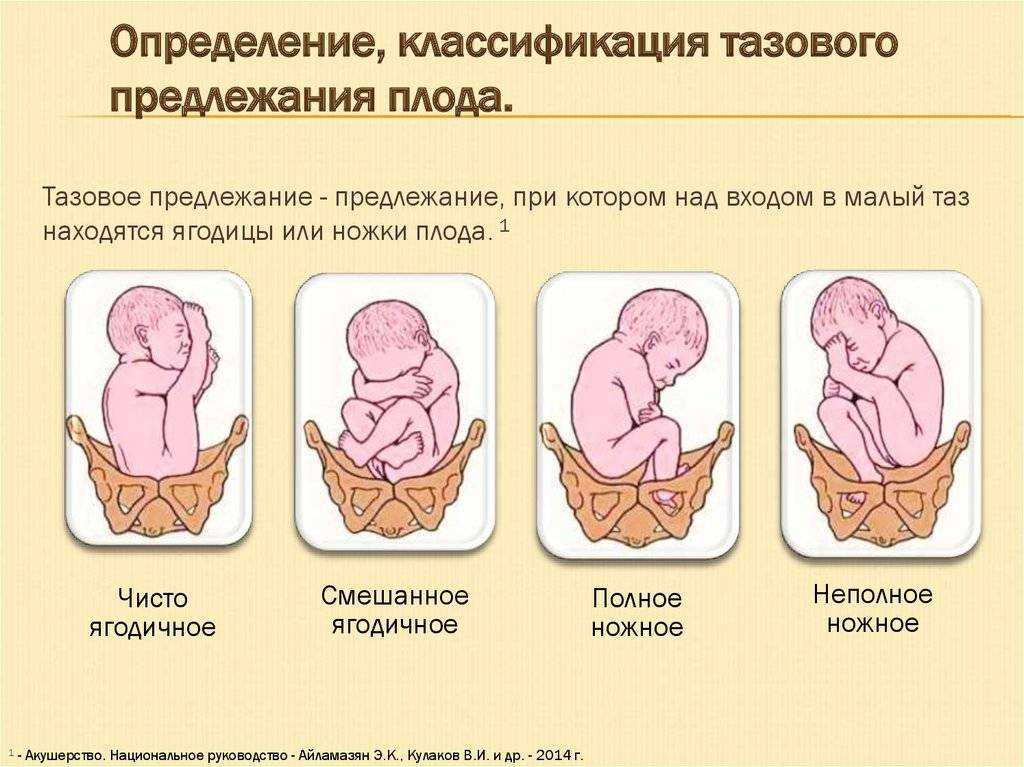 Головное предлежание плода: что это, виды, позиции, положения