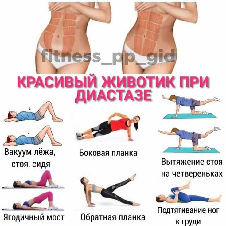 Какие упражнения при диастазе можно и нельзя делатьв закладки 28