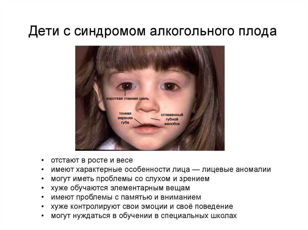 Современный взгляд на тератогенное влияние алкоголя при беременности. возможные меры профилактики | марянян | акушерство, гинекология и репродукция