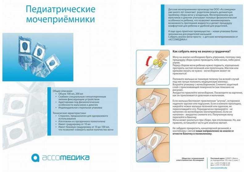 Как правильно собрать анализ мочи у новорожденного