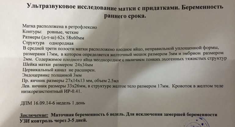 Для чего делать узи шейки матки (цервикометрию)