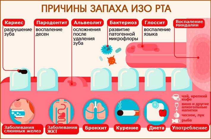 Запах ацетона изо рта у ребенка может говорить о наличии сложных заболеваний, лечение которых важно начать вовремя