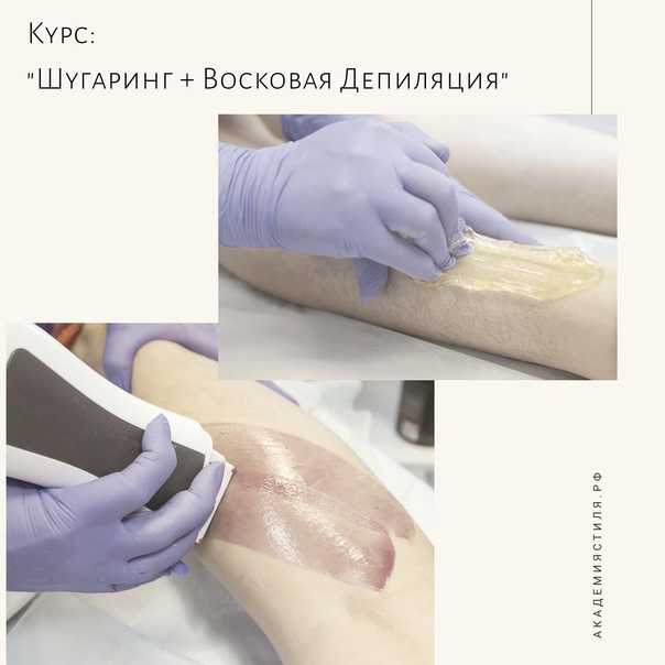 Что лучше шугаринг или восковая эпиляция? какой способ выбрать?