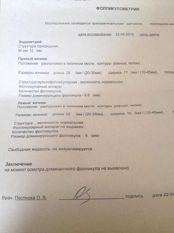 Овуляция: что это, симптомы, когда наступает и сколько длится